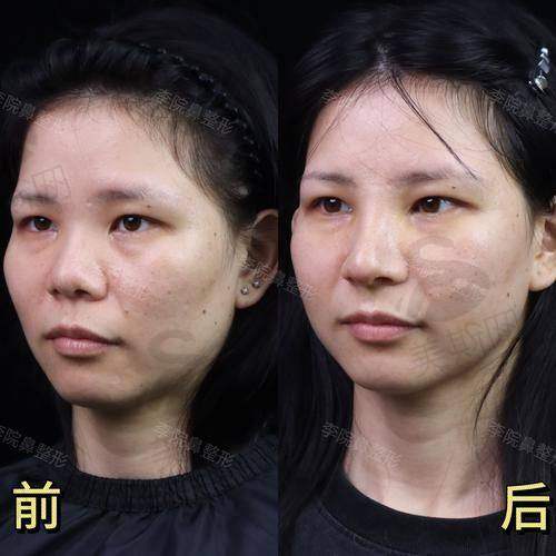 2025版拉萨正规美容医院排名榜刷新！拉萨市医学整形美容中心、XX医美医院等榜上有名！ 