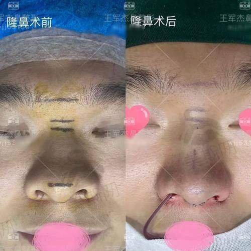 总结