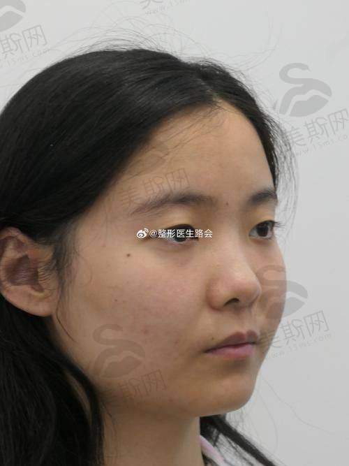 长春美容整形骨干医生手术的价格因素