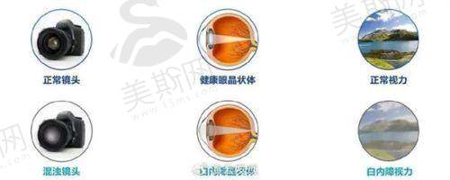 北京同仁眼科哪个医生好?总结:对症选医是关键,这些“避坑点”要牢记!