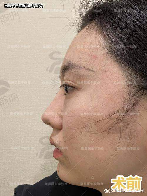 6.2 在线弹窗询问