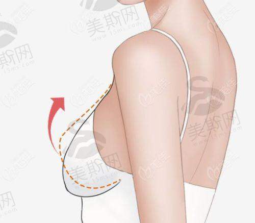 北京艺美王东五元起化丰胸108000元起,核心优势在哪里?