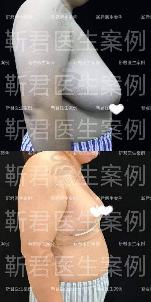 修复日记:从