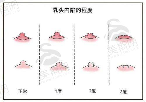 三、杭州栗勇医生不同技术价格表
