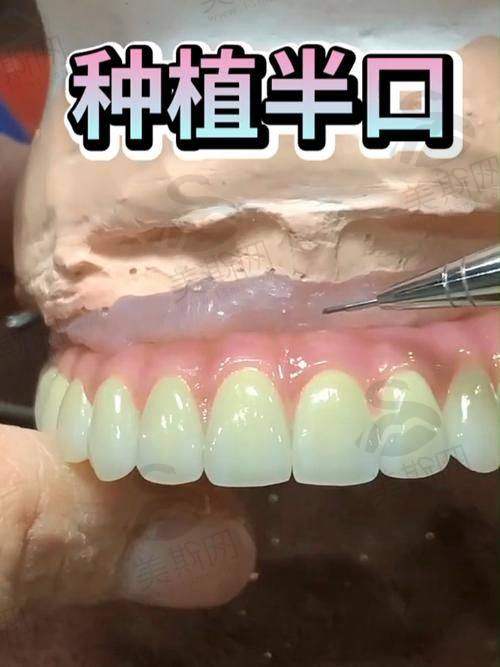 口腔医院口碑实例