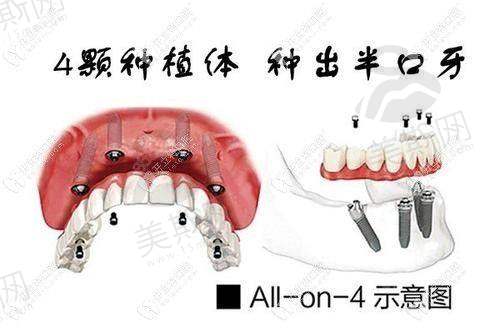 上海长宁区中山公园附近牙科的口碑评价汇总