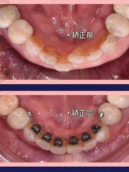 总结