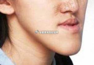 上海薇琳口腔医院的牙齿矫正项目有什么特色
