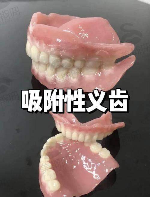 如何选择适合自己的天津口腔医院做全口假牙