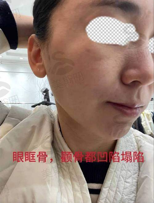 陈小平医生面诊预约攻略:3种方式更快抢到号,避免跑空!