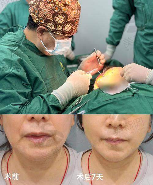 王阔远预约指南:想找他面诊?这几个渠道更靠谱