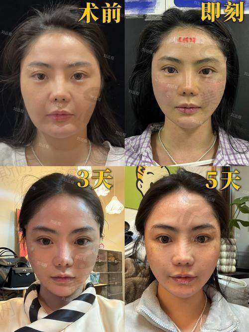结尾:想找陈小平医生做磨骨?先查好他的出诊时间表!