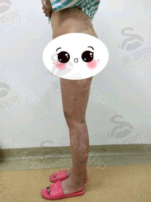 北京王阔远医术评价:生长因子取出为什么找他?“精细定位+完全清除”的双重保护