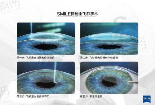 【北京同仁眼科电话号码】24小时预约挂号热线：急诊|咨询|医生排名一键查（附线上问诊入口）！