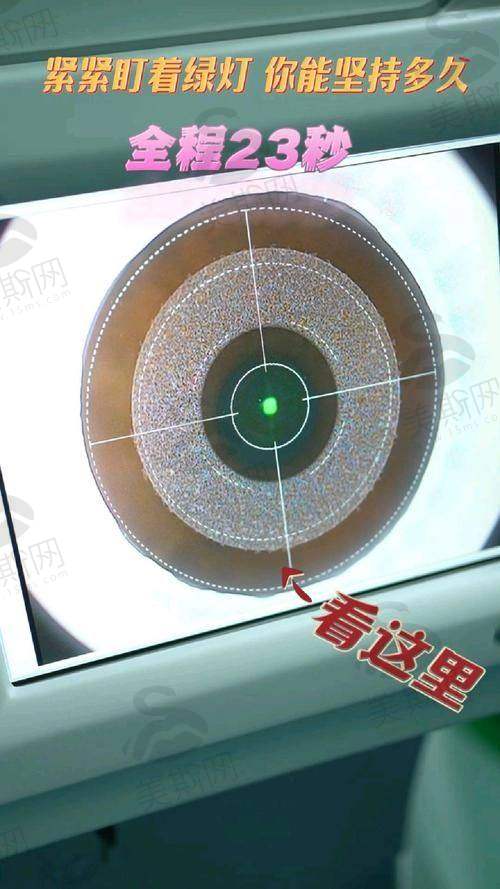 北京同仁医院眼科骨干医生出诊表:卢炜医生出诊安排及擅长领域