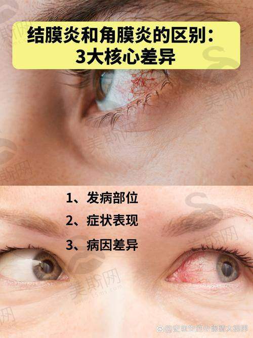 二、北京同仁眼科医院预约挂号法定网站没号?电话+微信双渠道“捡漏”!