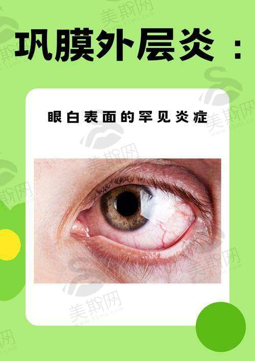 北京同仁医院眼科骨干医生挂号费用:不同级别医生收费标准