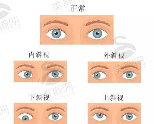 三、北京同仁眼科医院骨干医生出诊表2025（全新版）