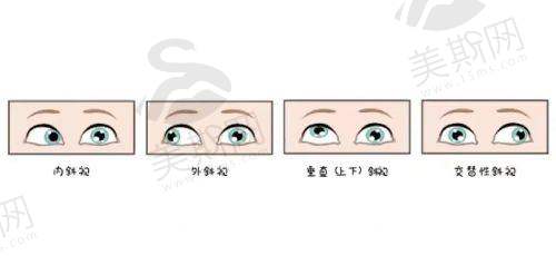 北京同仁眼科医院专家一览表查询2025：排名top10+出诊表出炉！熊瑛/赵阳等名医号紧俏
