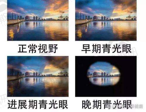 四、北京同仁医院眼科挂号是东区好还是西区好?挂号难度与预约攻略