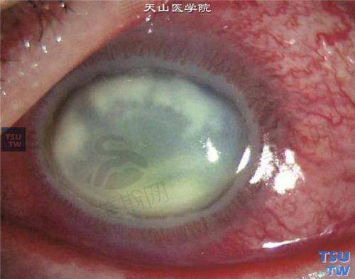 北京同仁眼科医院预约挂号平台其他预约途径(微信/现场/转诊)