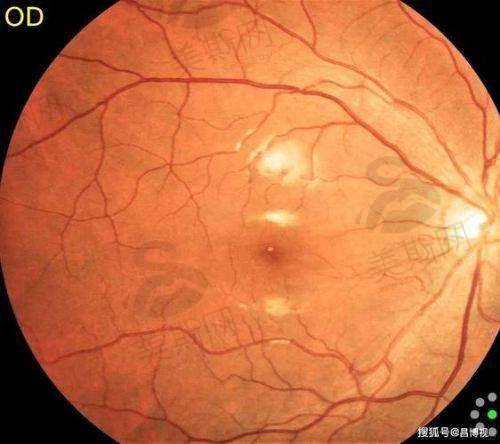 七、北京同仁医院眼科挂号是东区好还是西区好?避坑要点与注意事项