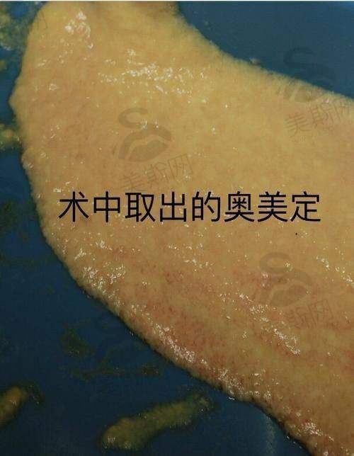 (一)擅长项目详情及价格