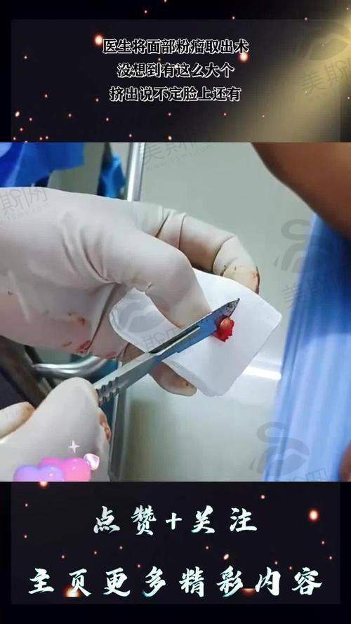 (一)胸部整形组合套餐