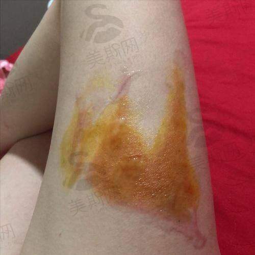 选择成都整容医院的关键要点