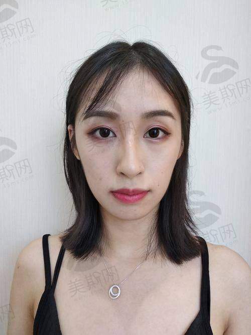 三、陈小平医生擅长的项目:除了磨骨,他还有哪些“拿手好戏”?