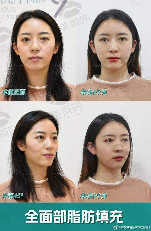 王阔远医生简介:30年整形经验,“面部轮廓”的“细节控”