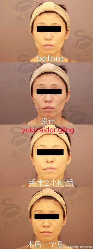 王阔远医生口碑:患者说“他比我更懂我的脸”