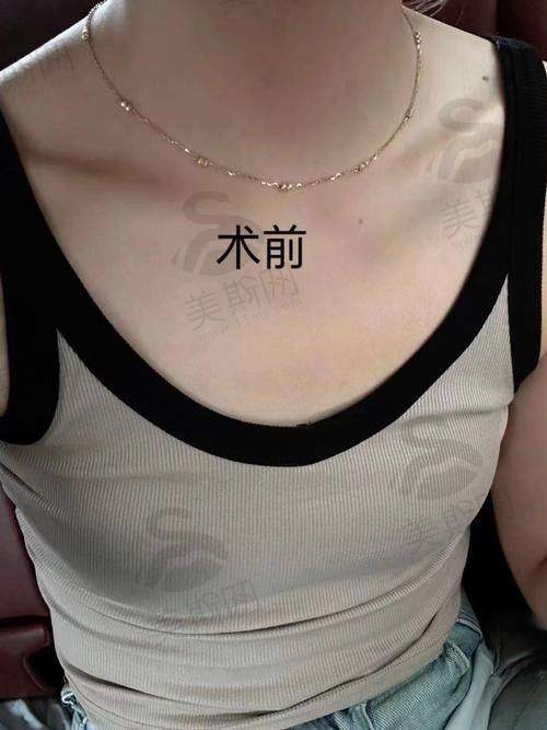 (一)预约渠道