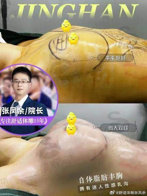 北京艺美王东五元起化丰胸价格108000元起,医院实力如何支撑?