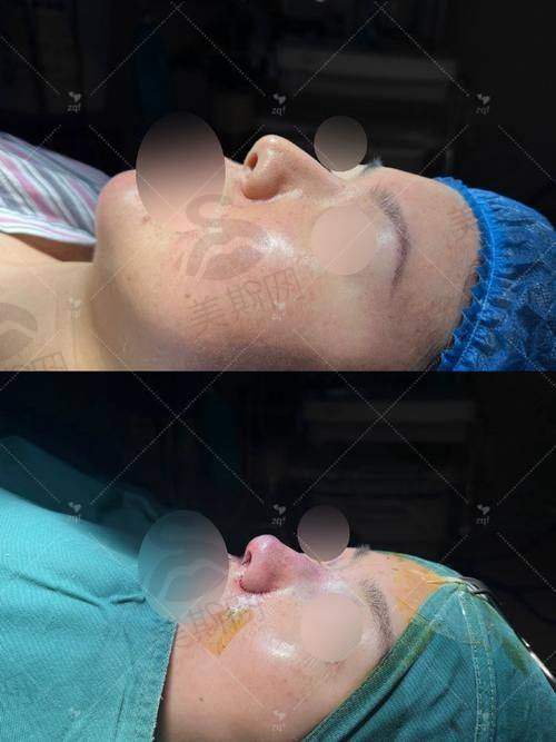 2025年北京华韩谢立宁鼻综合预约流程:4种方式快速挂号