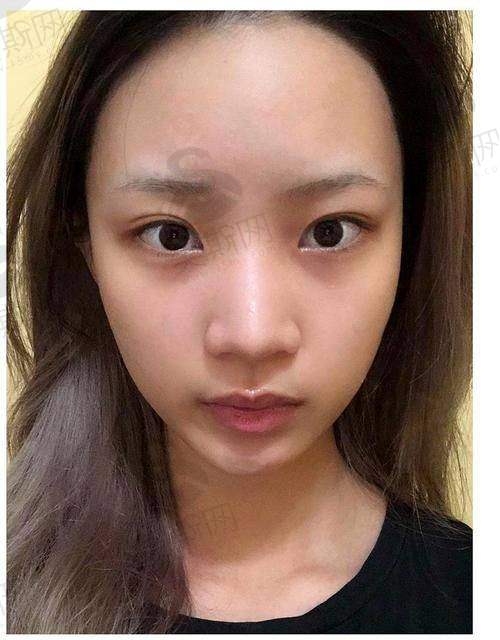 支撑谢立宁鼻综合的北京华韩医院实力:10万+成功实例的技术背书