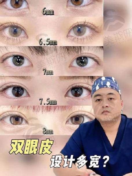 宁波市解**1**医院整形科价格表（2025版）公布，宁波市解放军医院双眼皮3800元、隆鼻5500元、吸脂8000元起！ 