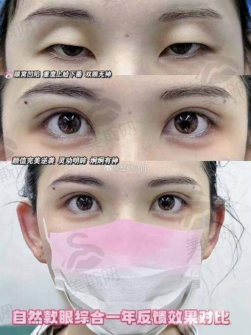台州整形医院哪家好？——各有千秋的“明星”医院