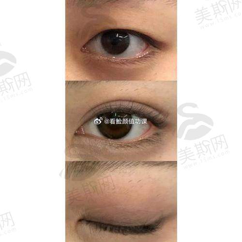 广州眼综合整形医院的服务特色