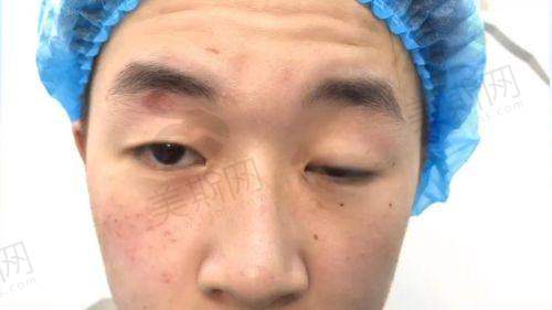 广州做眼综合口碑好的医院有哪些？曙光、华美、广大等医院排名靠前值得选！ 