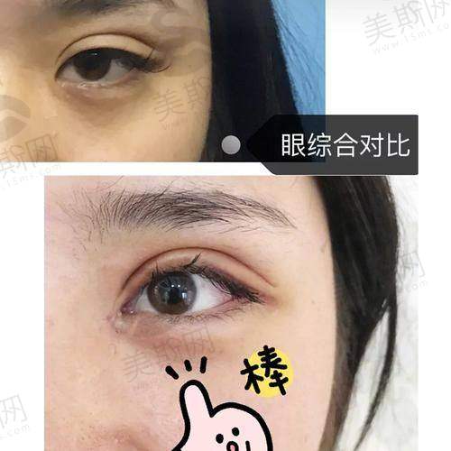 明星常去的韩国id医院全脸整容要花多少钱？地址、价格表、医生信息一文揭秘！ 