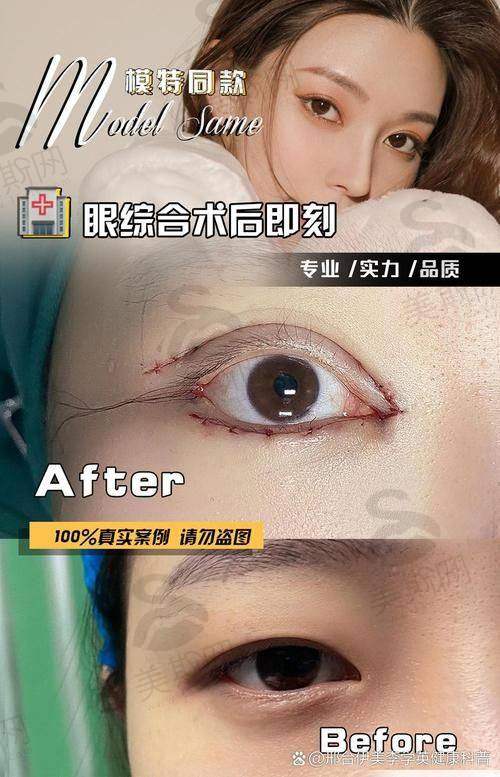 十强佛山做面部整形手术好医院有医生生介绍