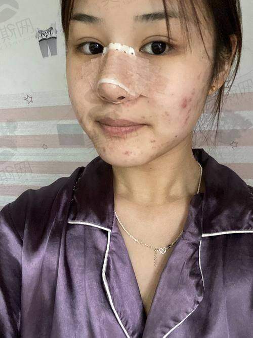 总结