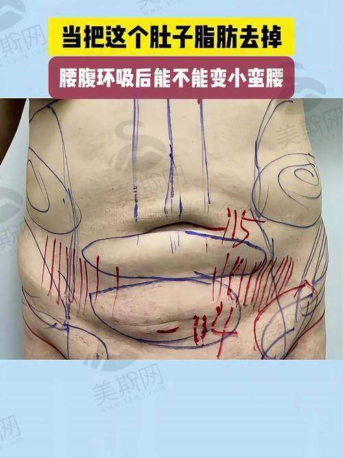 十强佛山做面部整形手术好医院地址