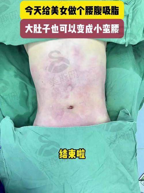 选择佛山面部整形医院的关键要点