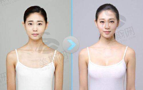上海排名前十的大型整形医院怎么样？美莱、伊莱美、艺星技术优，地址价格电话全知晓！ 