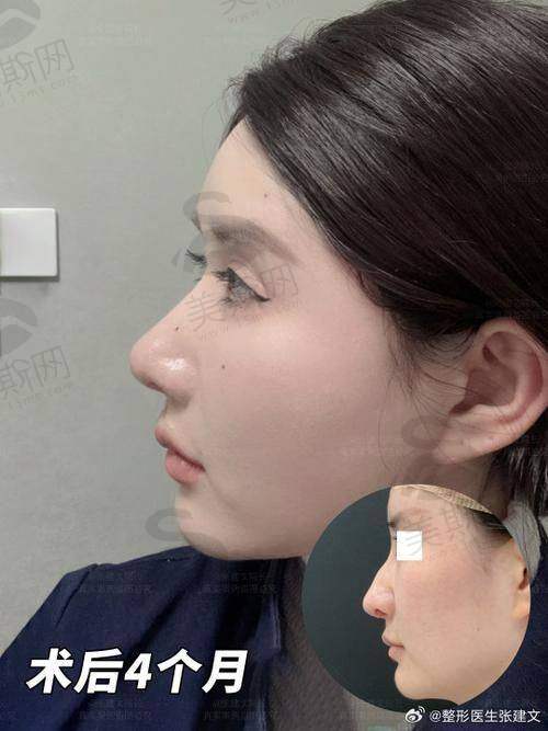 上海排名前十整形医院的热门项目介绍