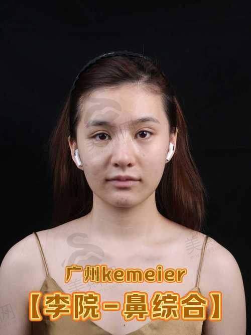 选择重庆正规整形医院的关键要点