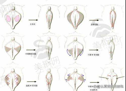 广州韦瑞莲医生价格情况