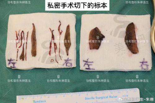 广州韦瑞莲医生口碑情况
